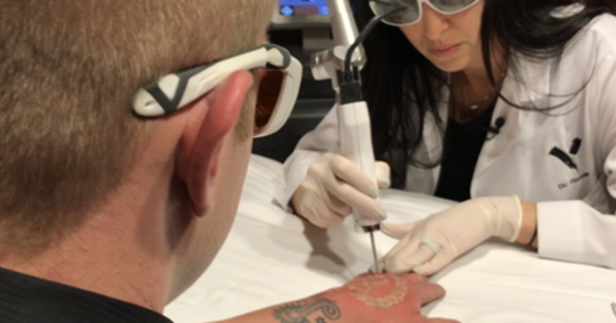 'It's time to start moving forward' Denver man removes tattoo to
